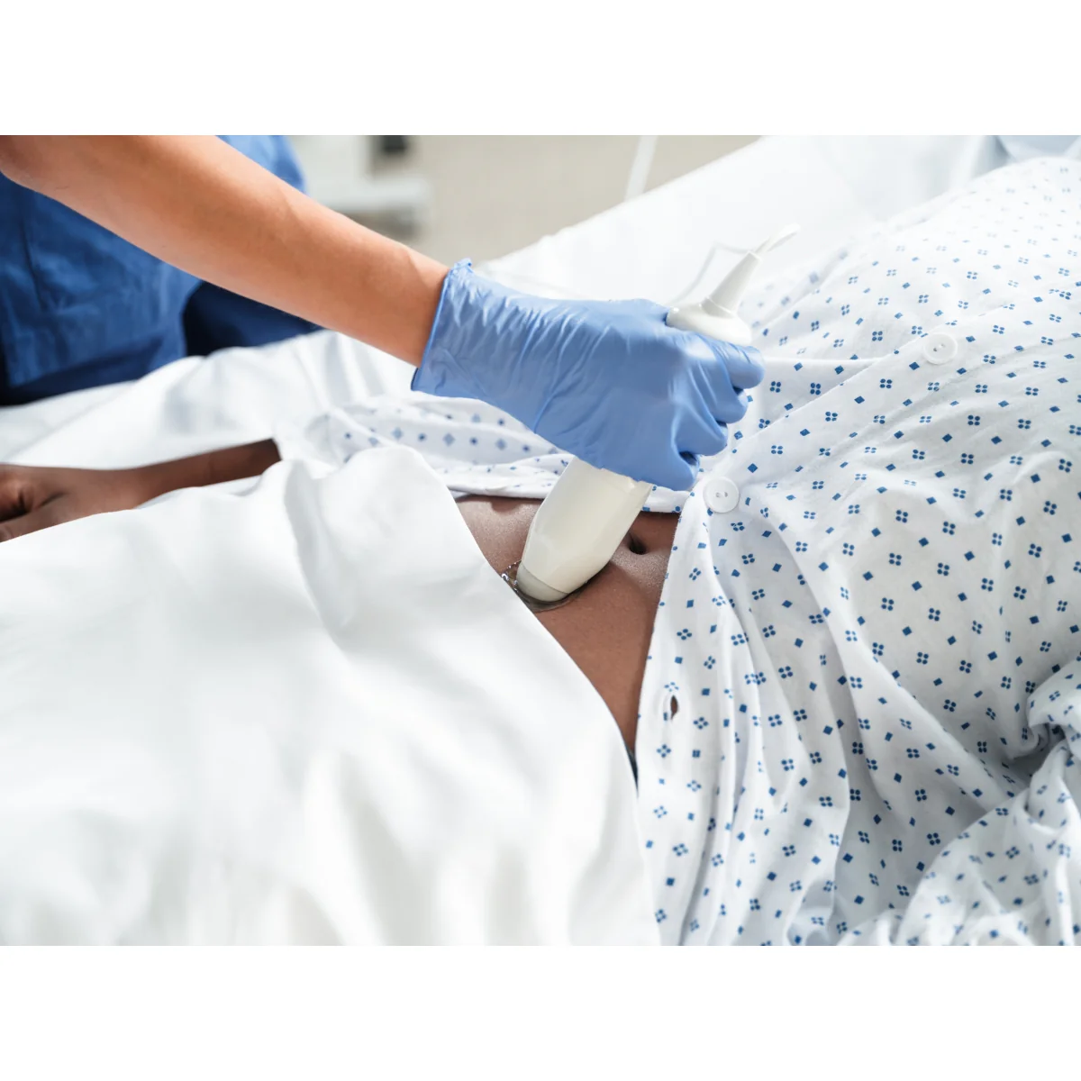 Bladder scanner VitaScan - Image 12