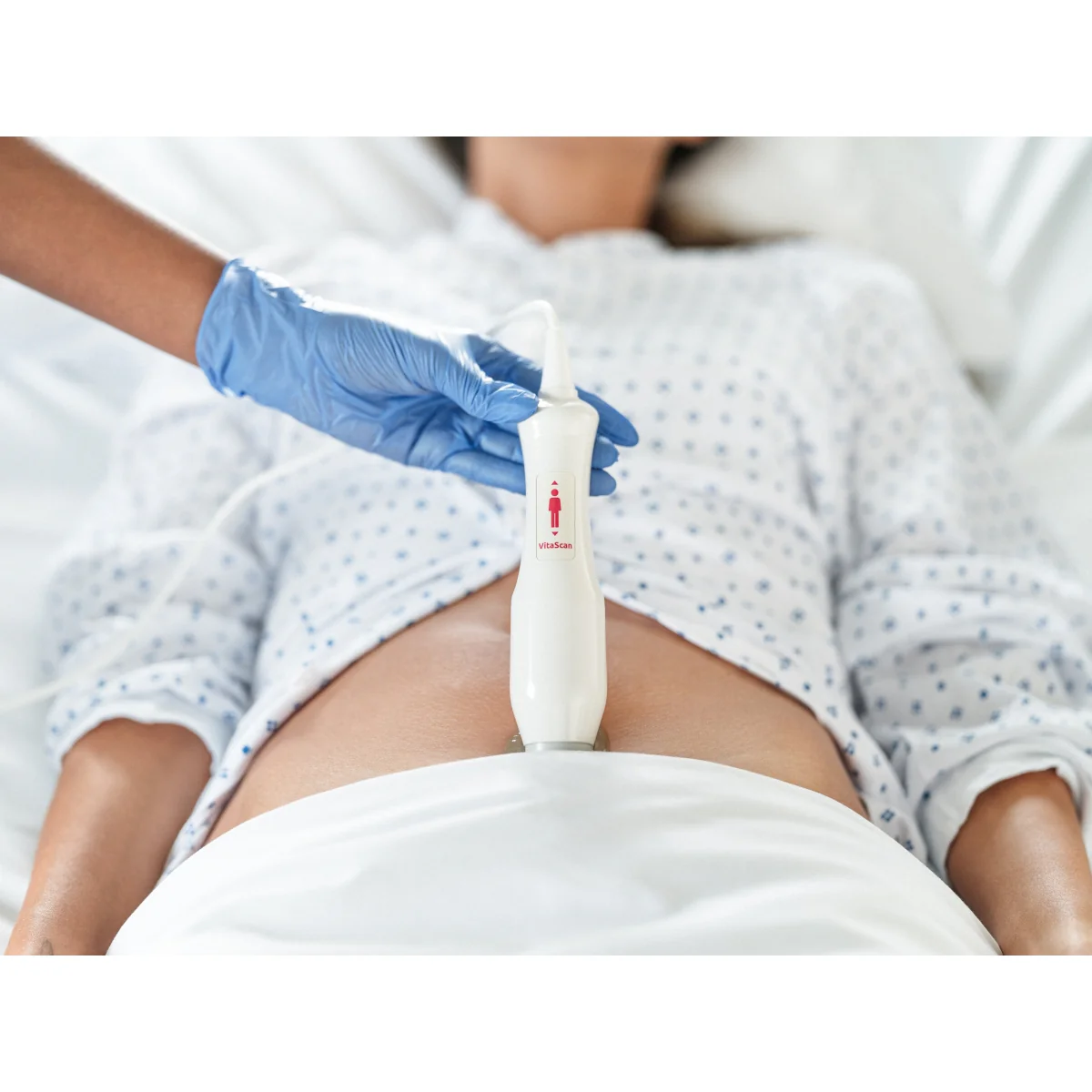 Bladder scanner VitaScan - Image 5