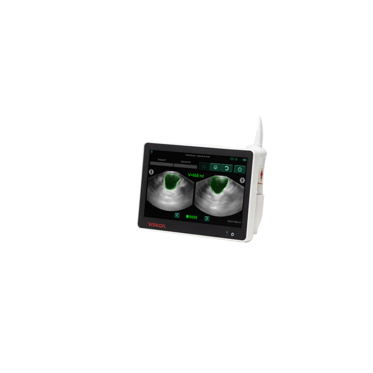 Bladder scanner VitaScan - Image 9
