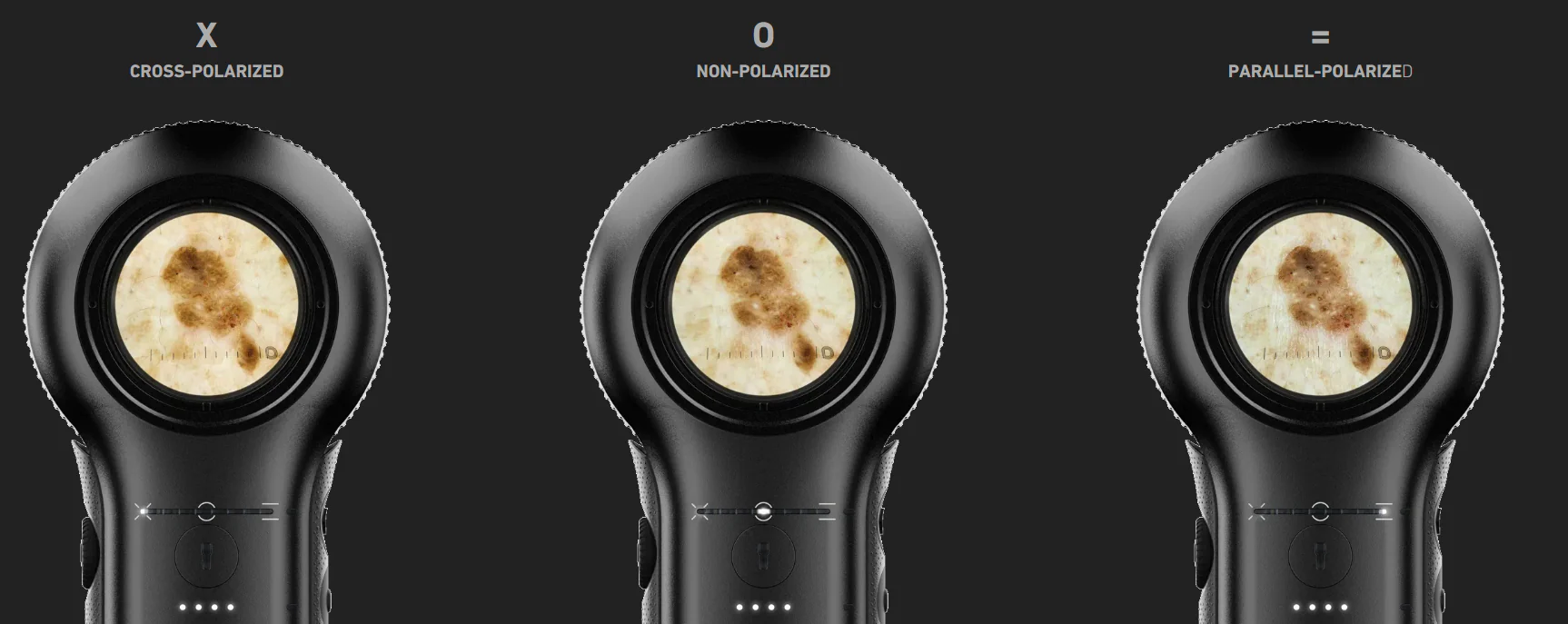 Dermatoscope DermLite DL5 - Image 6