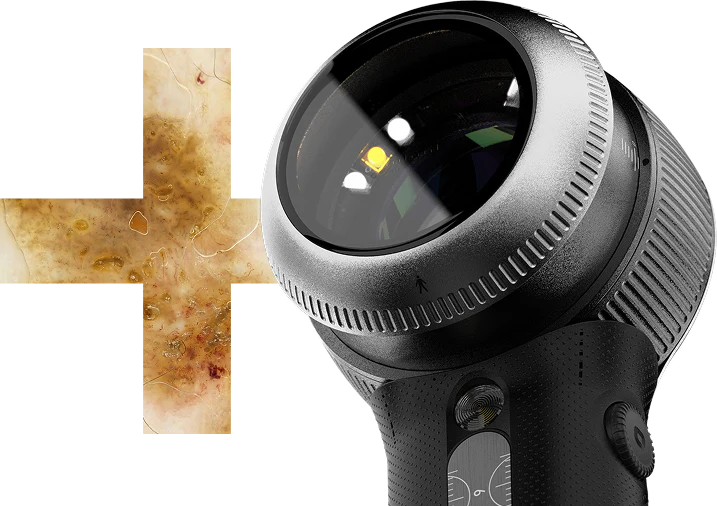 Dermatoscope DermLite DL5 Plus - Image 4