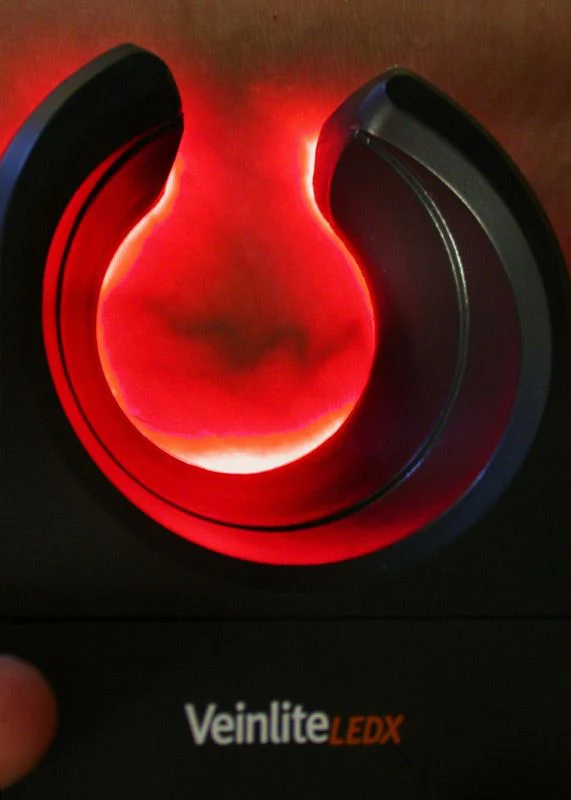 Veinlite LEDX® - Transluminateur portable - Image 4