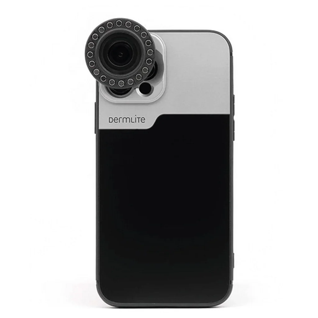 Kit de Connection DermLite pour IPhone 14 et 15 (Plus, Pro, Max)