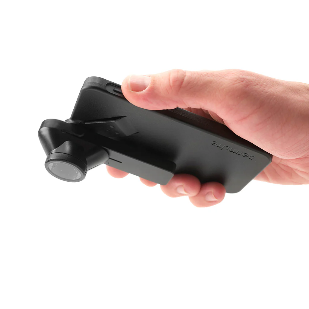 Dermatoscope Dermlite DL1 - Image 2