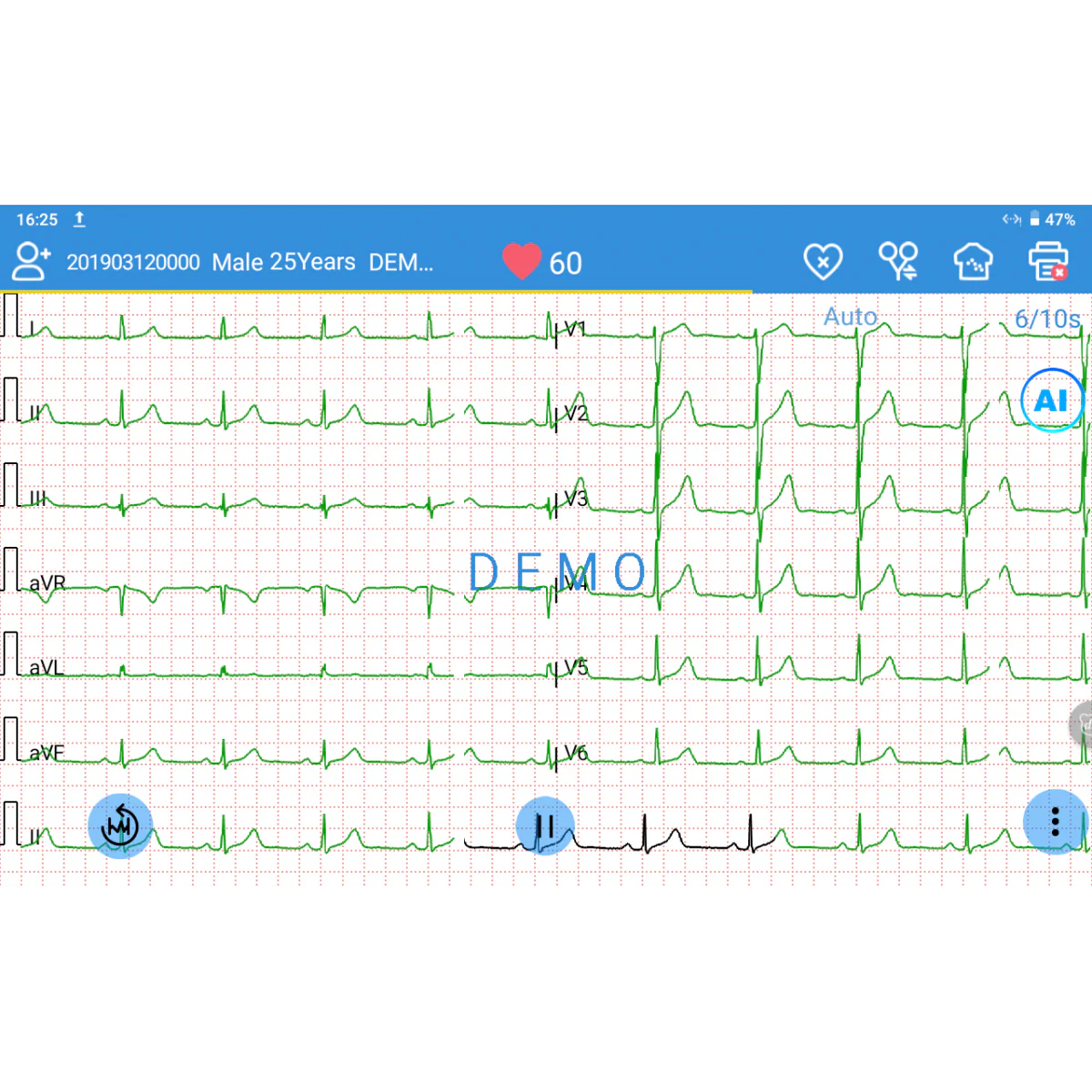 ECG EDAN SE-1200 Pro 12 pistes, tactile avec imprimante - Image 5