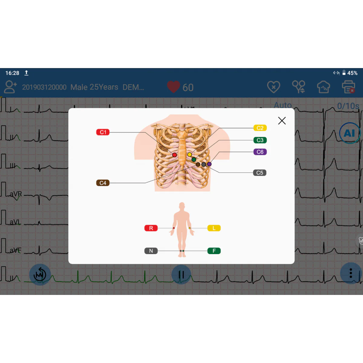 ECG EDAN SE-1200 Pro 12 pistes, tactile avec imprimante - Image 6