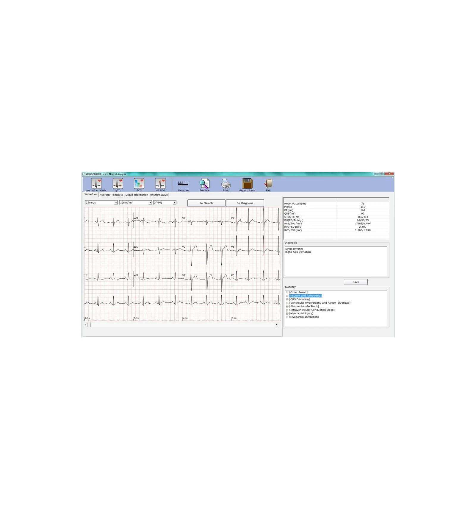 ECG PC SE-1010 Edan - Image 5