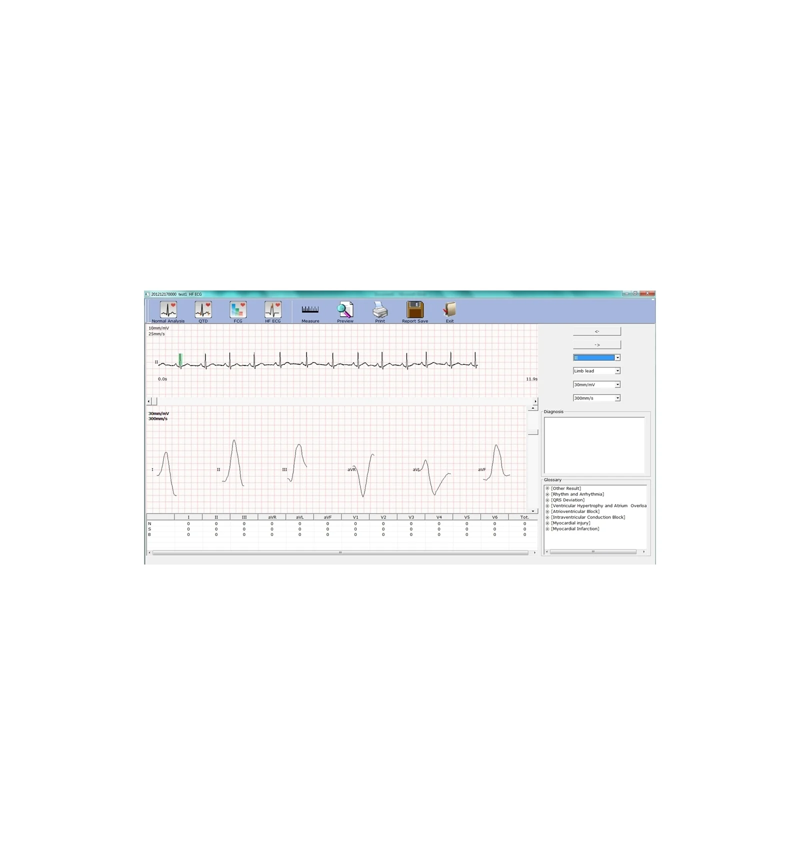 ECG PC SE-1010 Edan - Image 6