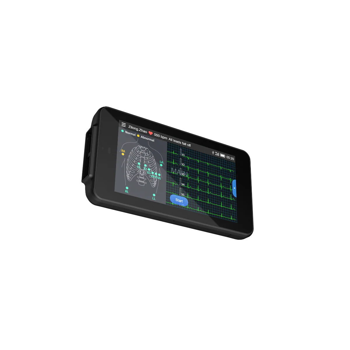Tablette ECG de poche Cardio One Mini - Image 2