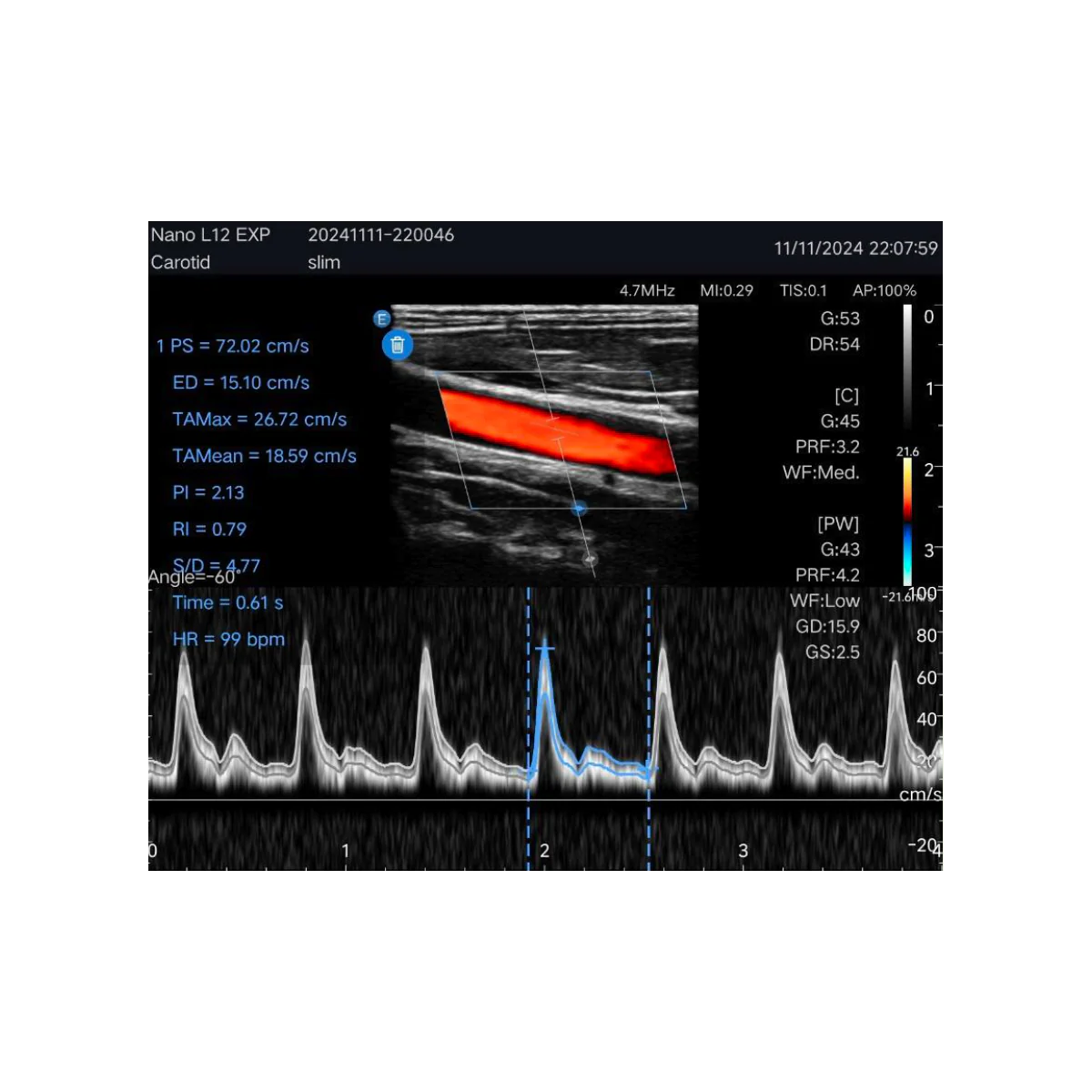 Echographe couleur portable Edan Nano linéaire - Image 4