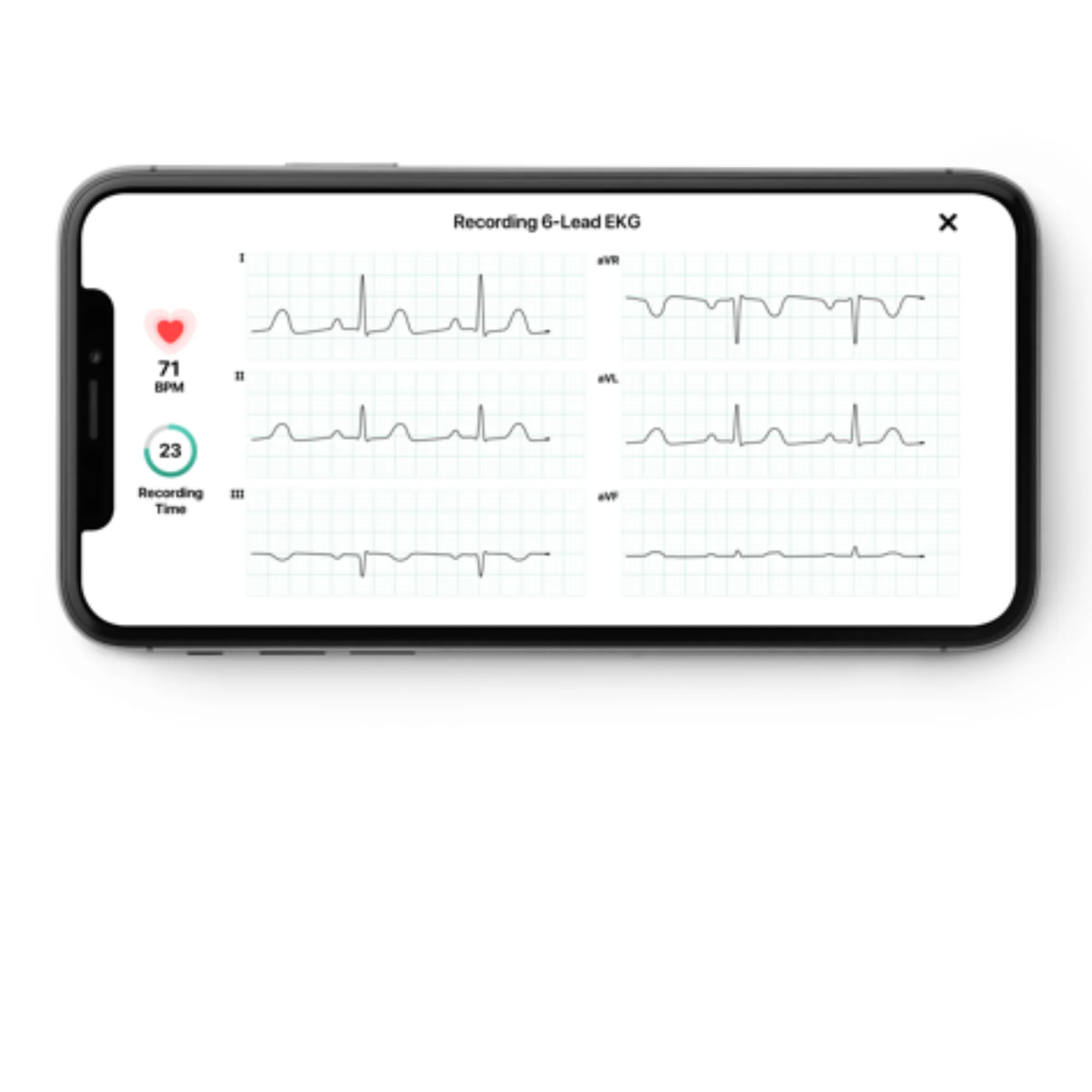 ECG connecté KardiaMobile 1 et 6 dérivations - Omron - Image 8