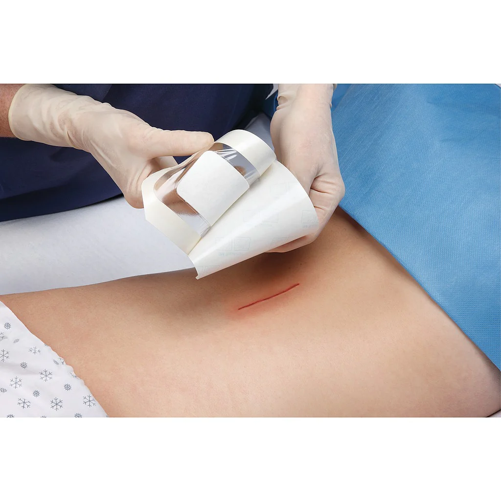 Pansement adhésif stérile transparent avec compresse 3M™ Tegaderm + Pad - Image 2