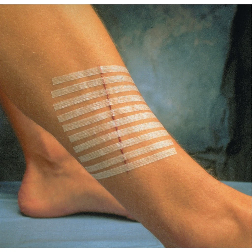 Sutures cutanées adhésives Steri-Strip - Image 3