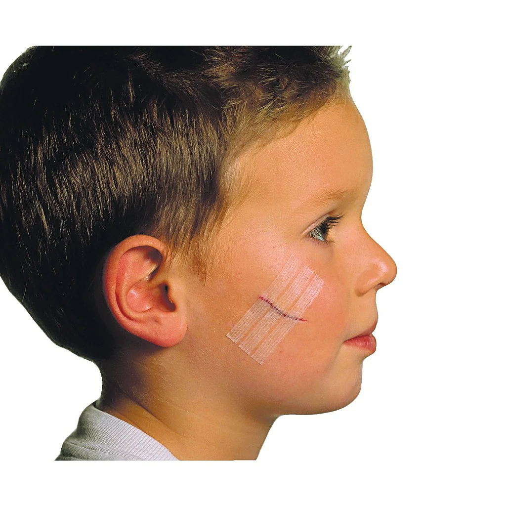 Sutures cutanées adhésives Steri-Strip - Image 4