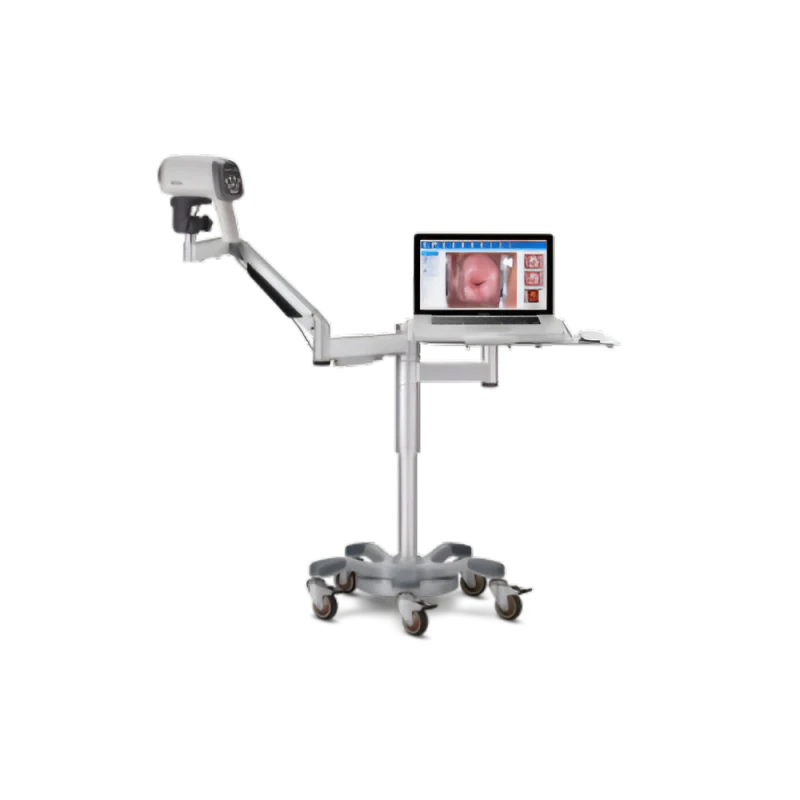 Vidéo-colposcope C6A- EDAN - Image 3