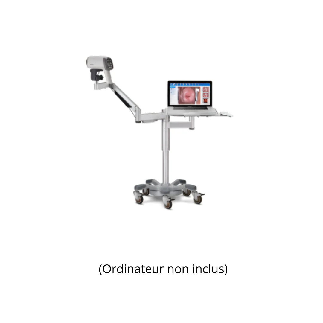 Vidéo-colposcope C6A- EDAN - Image 4